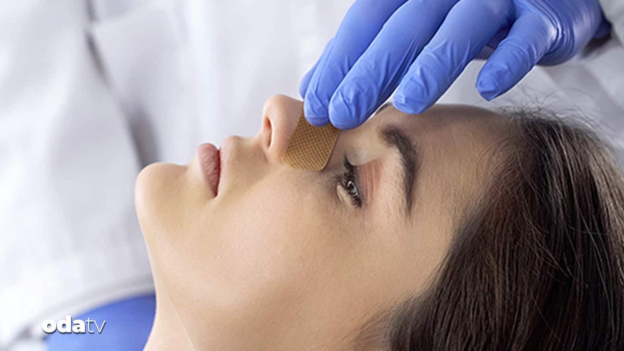 bakanliktan burun ameliyatlarina emsal karar VLzFdNFY